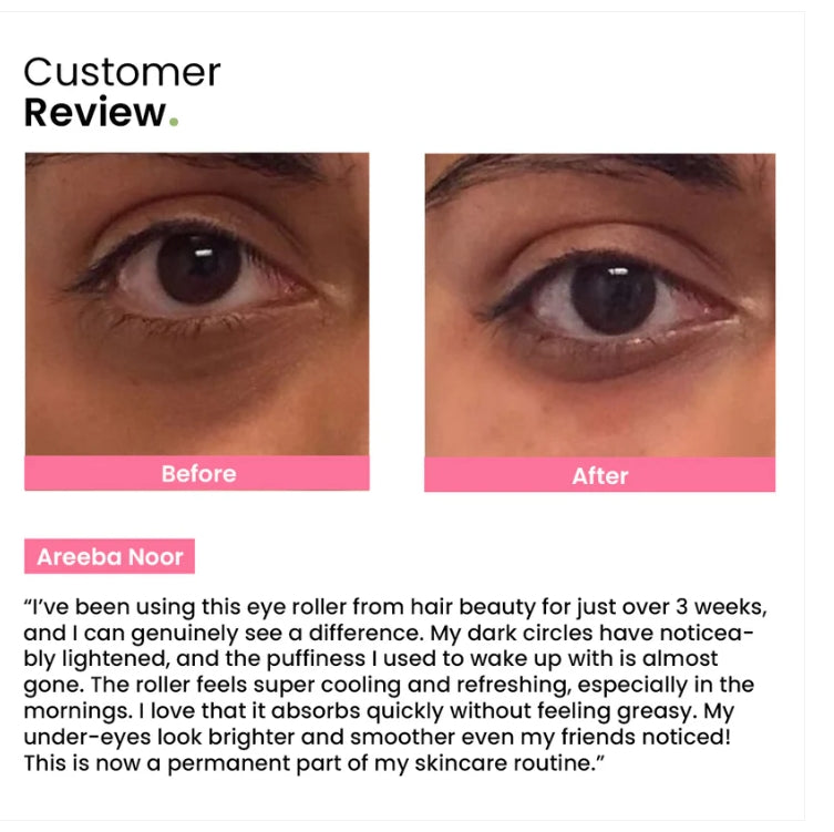 Eye Roller | Eliminates Dark Circles & Puffy Eyes