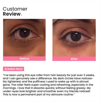 Eye Roller | Eliminates Dark Circles & Puffy Eyes